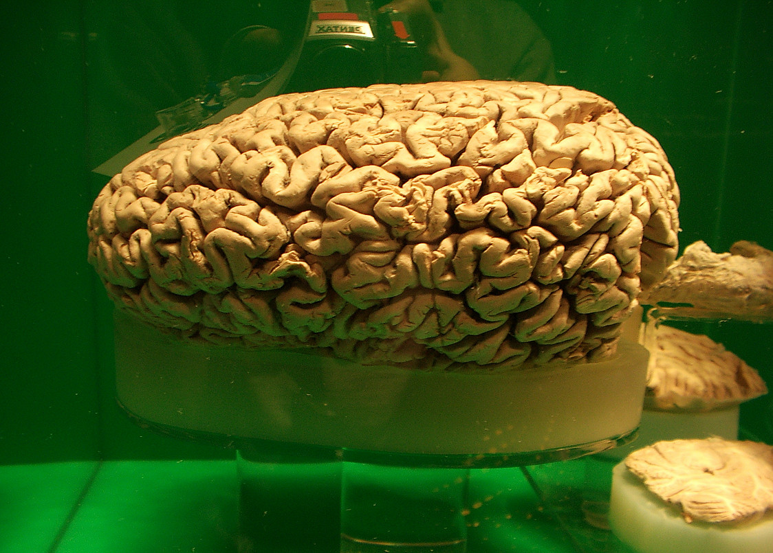 Preserved sperm whale brain.jpg